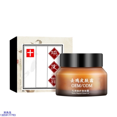 呼伦贝尔市_去鸡皮肤毛刺毛角周滋润修复保湿身体霜